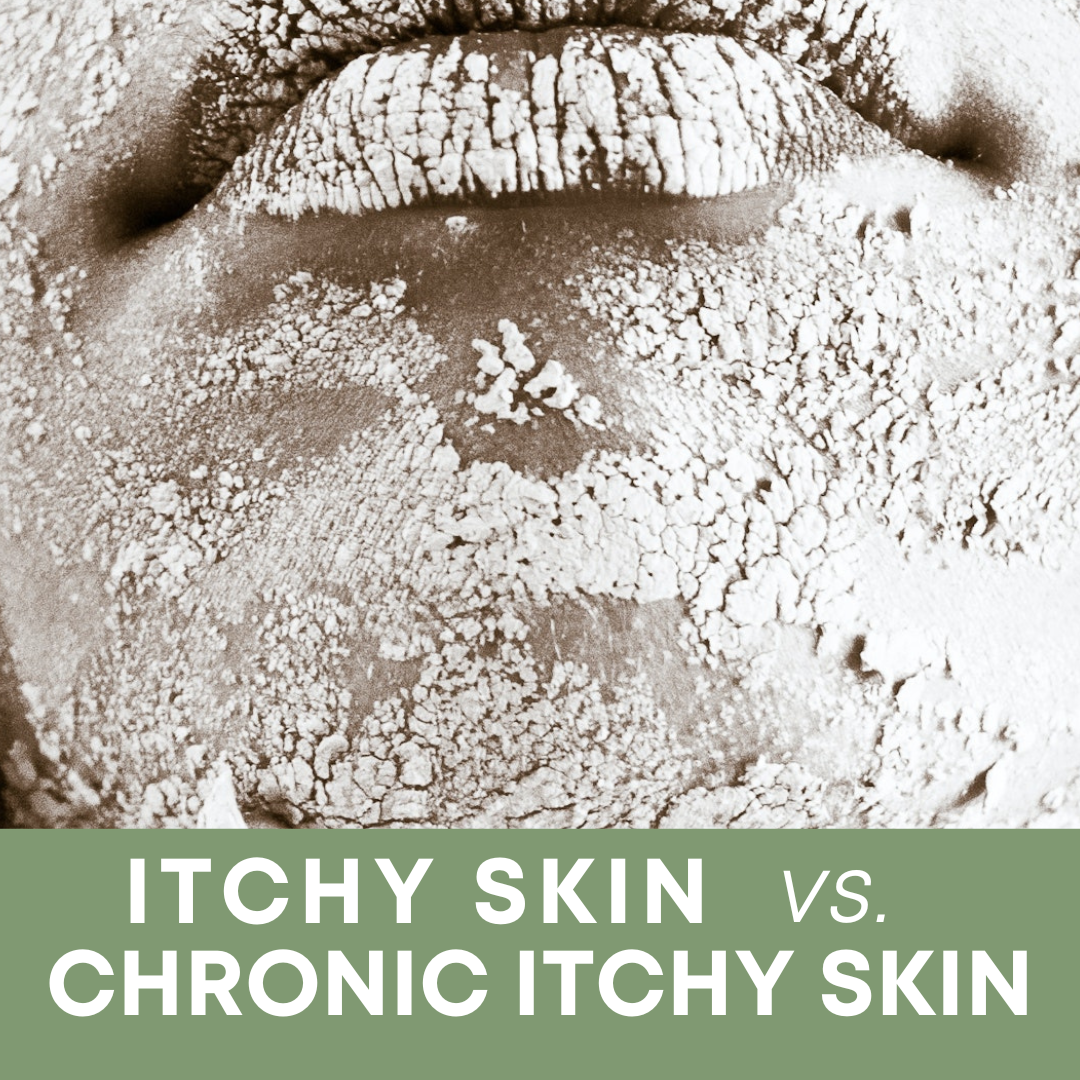 Itchy Skin versus Chronic Itchy Skin