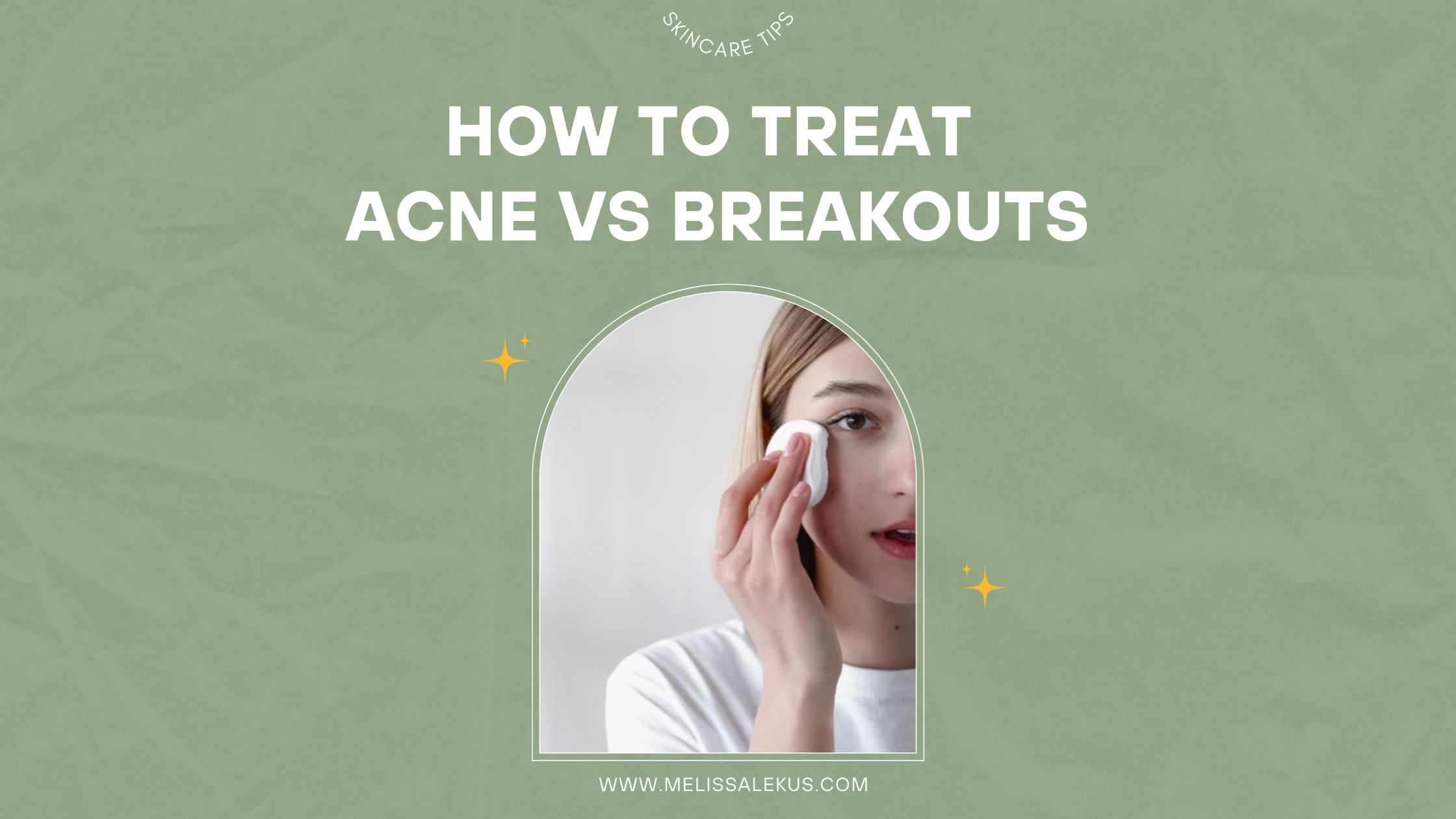 What to know about acne versus breakouts